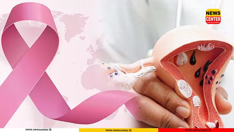 කාන්තා පිළිකා අතර ගැබ්ගෙල පිළිකා 05 වන තැනට 